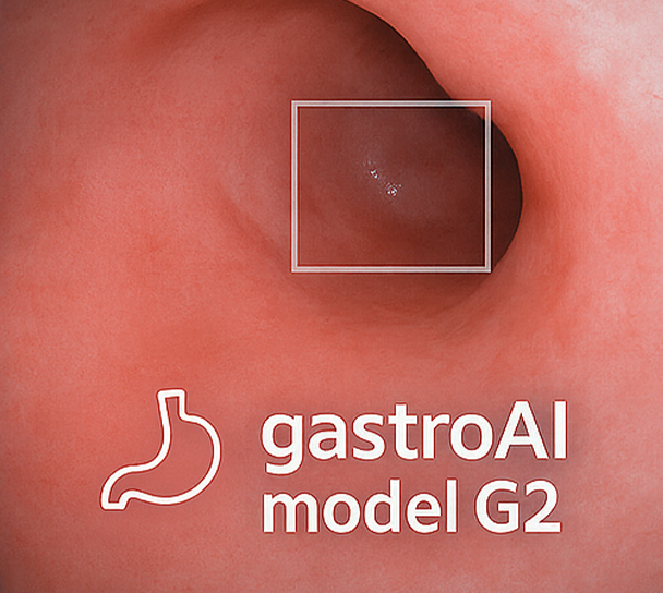 gastroAI modelG2